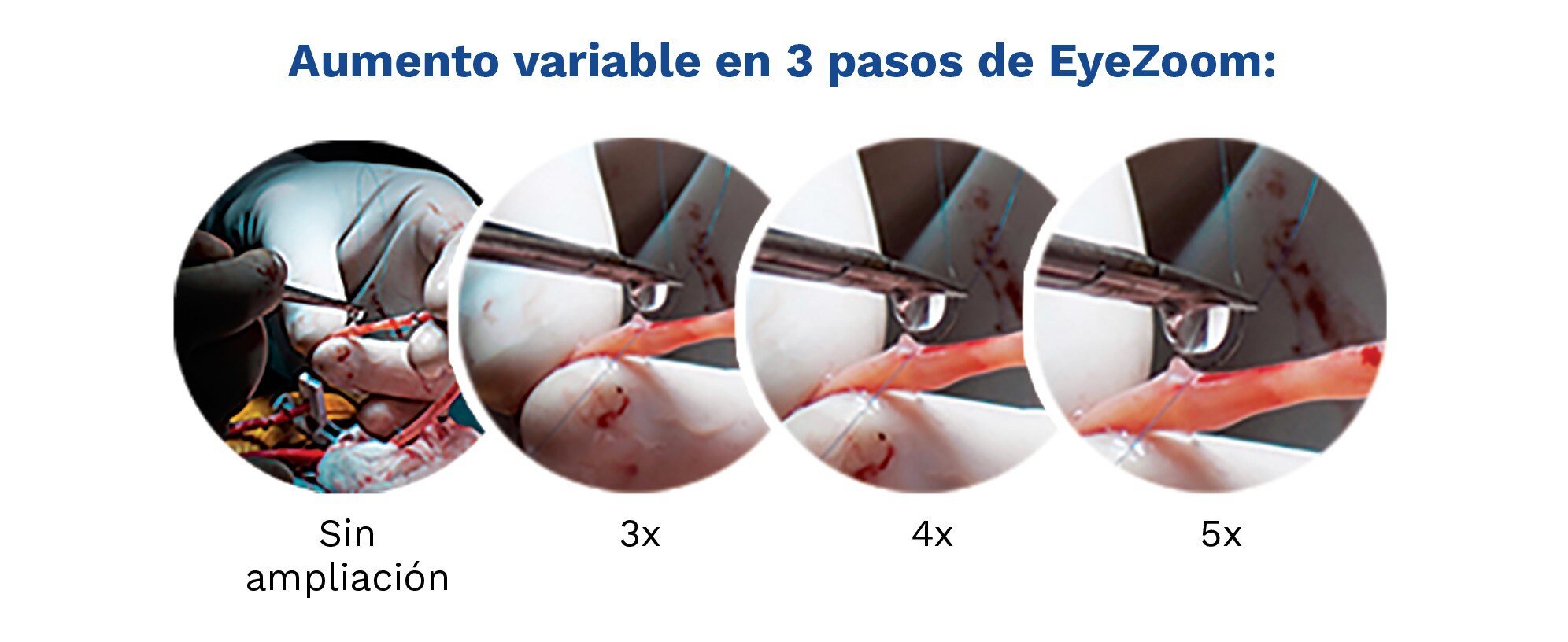 EyeZoom-3steps-ES